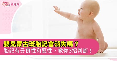 新生兒 胎記|胎記？蒙古斑？如何觀察與判斷診治｜Mombaby 媽媽 